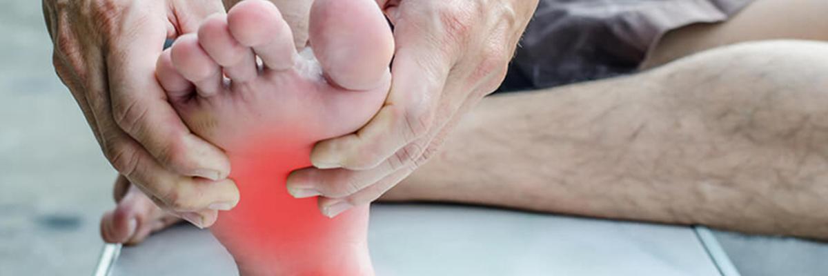 Fascitis plantar y su tratamiento en FisioClinics Alcobendas 